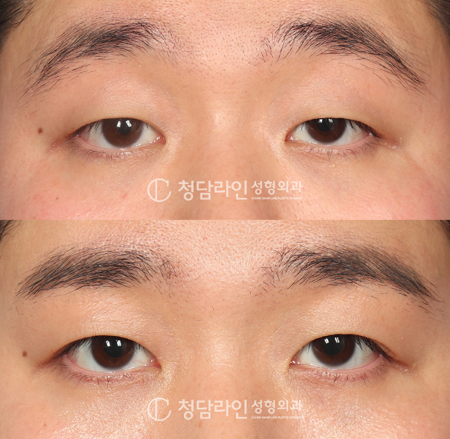 Before Image