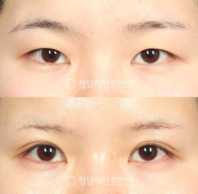 Before Image