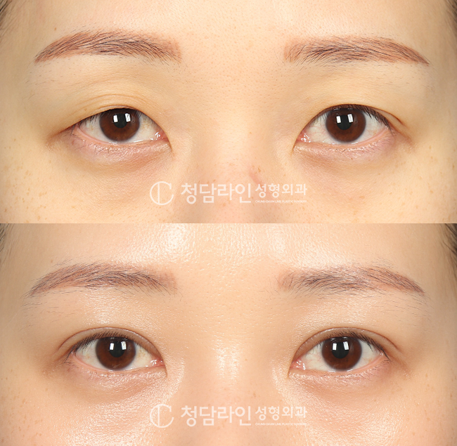 Before Image