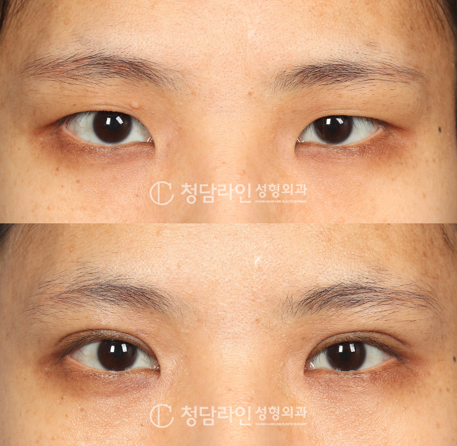 Before Image