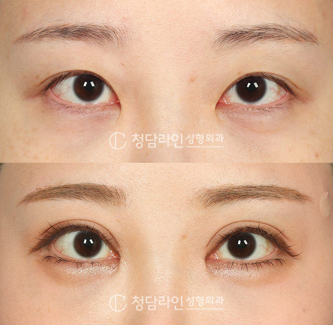 Before Image