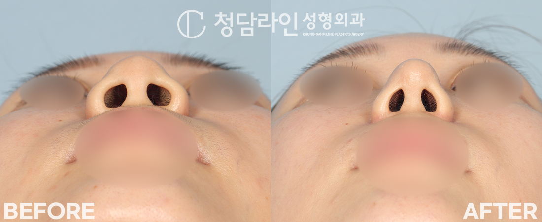 Before Image 3