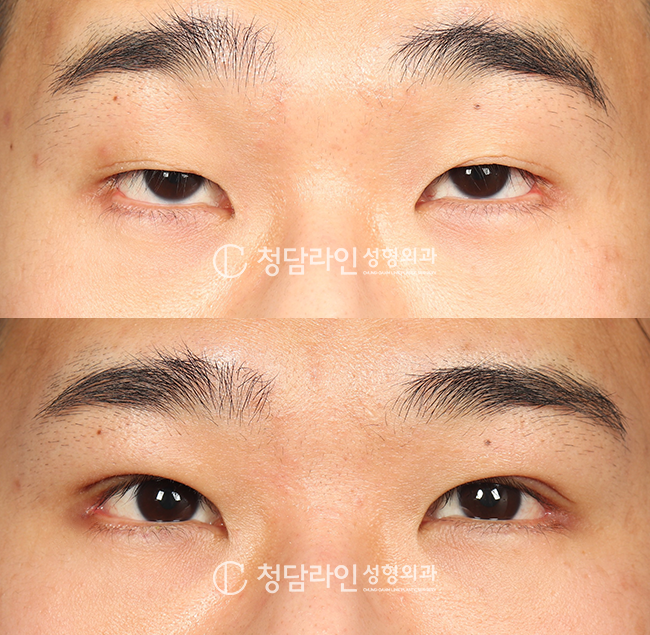 Before Image
