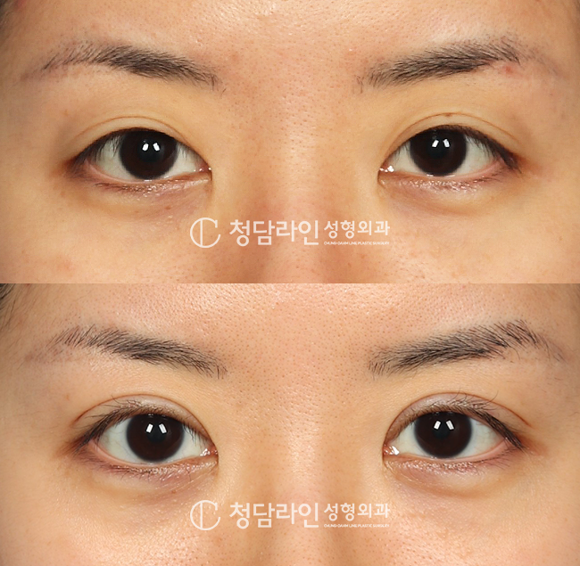 Before Image